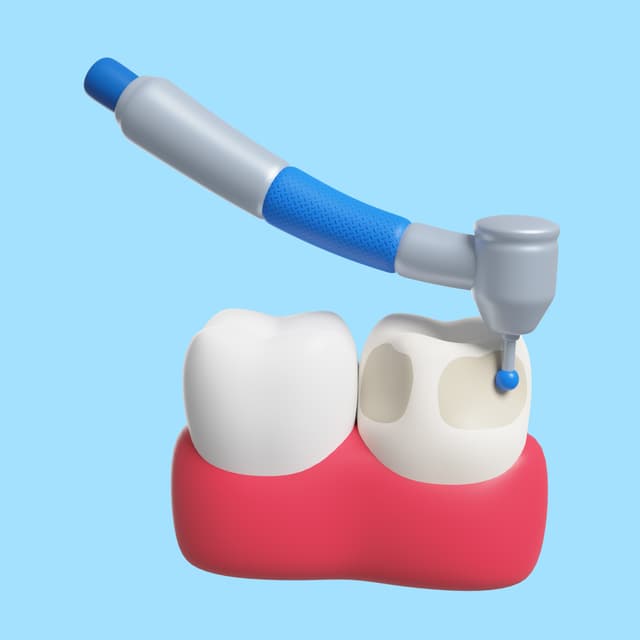 Root Canal