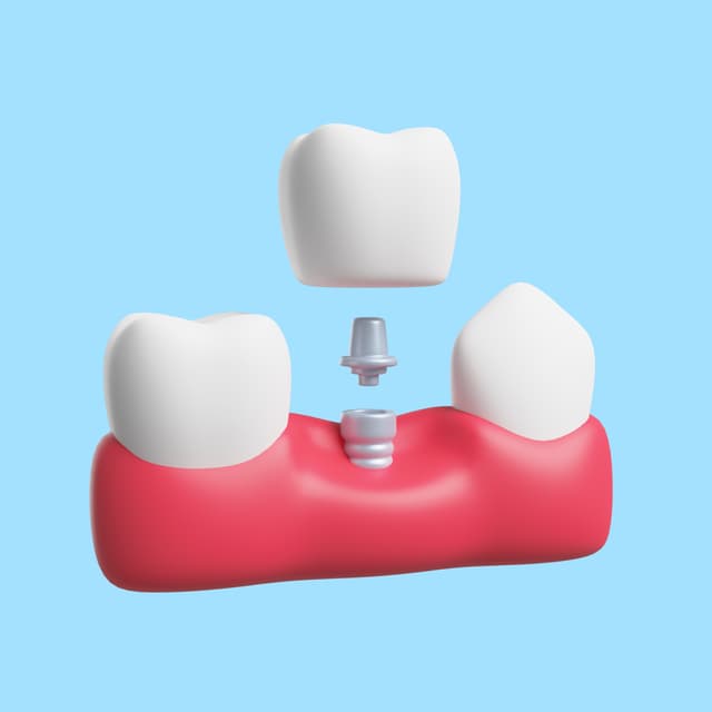 Implant