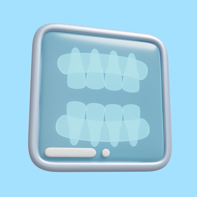 X-Ray